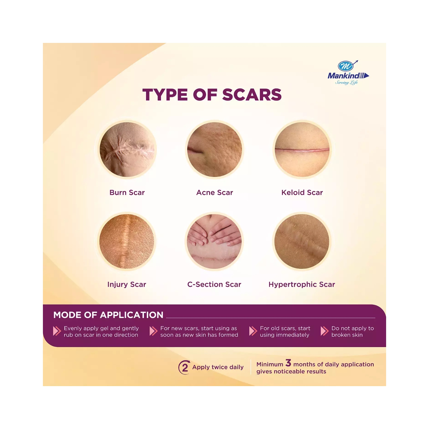 Mankind Scarend Silicone Gel (5)